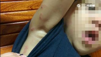 不滿女童吃飯慢　全身抓傷控師虐打