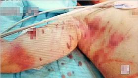 流浪狗,男童,圍攻,野狗,咬人,浪犬
圖／翻攝畫面