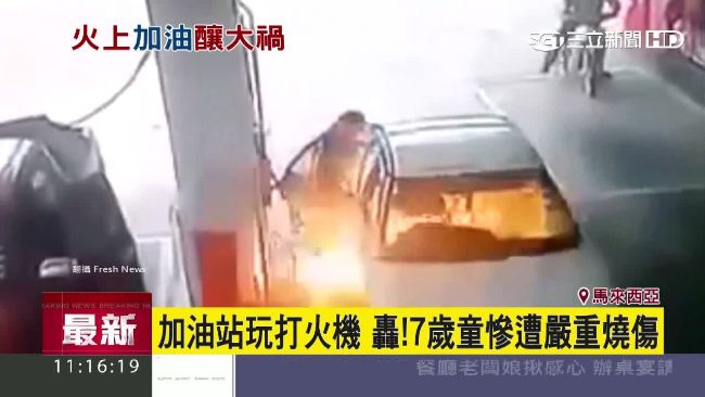 7歲童加油站玩打火機　慘遭嚴重燒傷