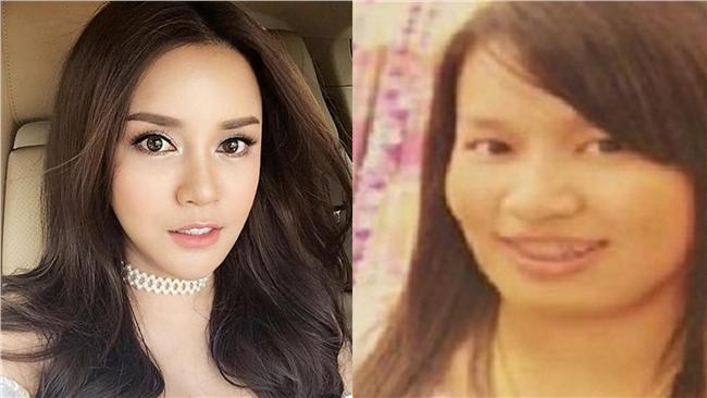 被小三嫌醜　她整成史上最美億萬富婆