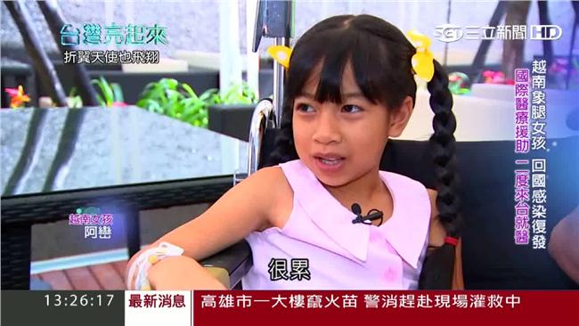 越南象腿女孩罹罕病！台灣跨國傳愛