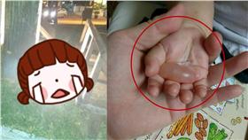 公園,暗器,崁燈,水泡,女童,燒燙傷,手掌,照明燈,高溫,警示,警告
圖／翻攝自爆料公社