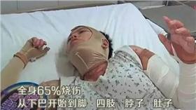 大陸河南孕婦被火燒傷/翻攝自微博