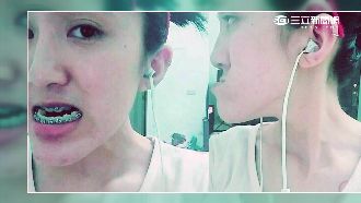 因戽斗自卑　女孩做完正顎手術變超美