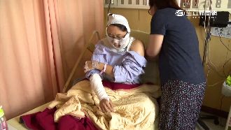 用熱水壺煮咖啡爆炸　女遭炸傷喊告