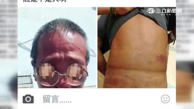 疑被逼簽86萬本票　老伯慘遭痛毆