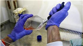 細胞、癌細胞、實驗、研究、治療、療法（圖／路透社／達志影像）