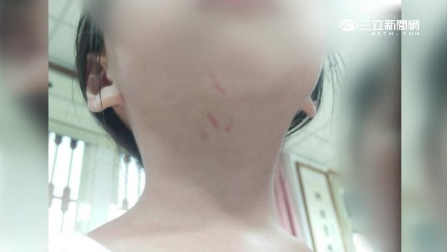 疑沒睡午覺遭師掐頸　女童泛淚哭訴