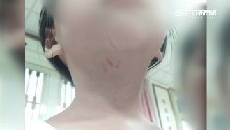 疑沒睡午覺遭師掐頸　女童泛淚哭訴