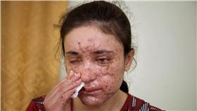 雅茲迪少女（（圖／美聯社／達志影像））