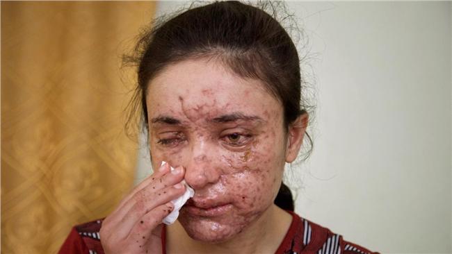 女童也遭殃！IS用通訊軟體賤賣性奴