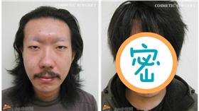 雙眼皮,整型,日本 圖/翻攝自2ch論壇