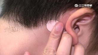 暈車貼片小心用！副作用造成視力模糊