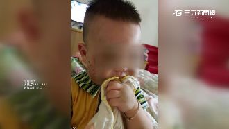 媽媽攜兒上摩鐵　1歲童竟遭虐全身傷