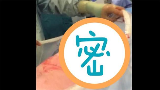 勇母「自然剖腹」　新生娃奮力爬出肚