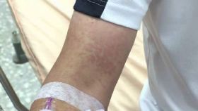 選手被蜂螫2400.