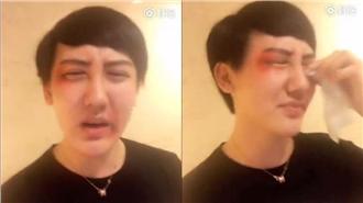 蛇精男泣訴遭痛毆　網友高喊打得好！