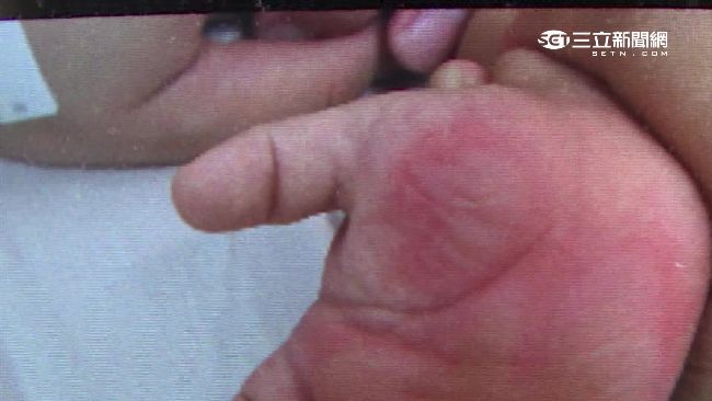女童尿褲子遭澆熱水　11小時後死亡