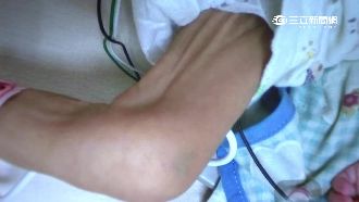 女嬰疑遭父母虐待　死前瘦如新生兒