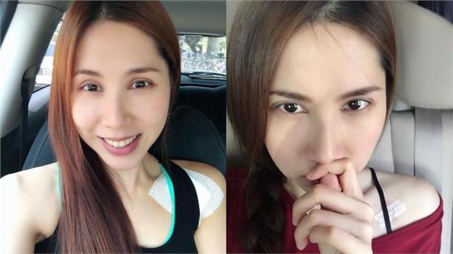 因手術傷口心情差　余苑綺看到他笑了