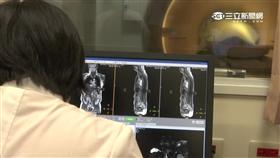 -斷層掃描-健檢-