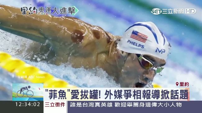 「菲魚」游泳露拔罐印記　嚇傻外媒