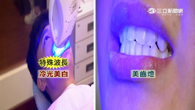 美齒燈能美白？牙醫：噱頭大於效果