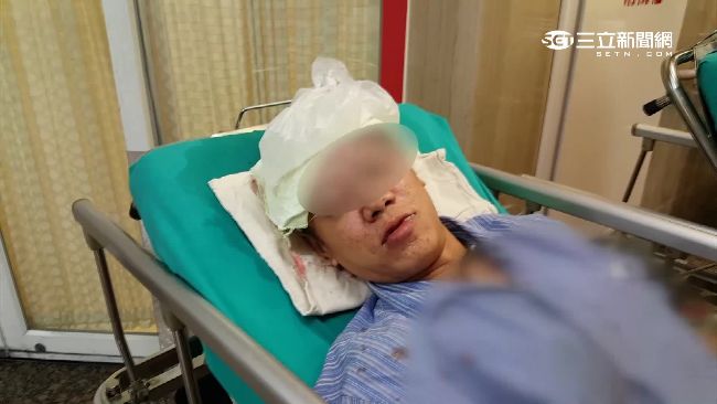 惡駕駛誤認行人比中指　拿扳手狠打頭