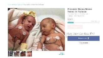 早產雙胞胎須開刀　外籍夫妻上網求助