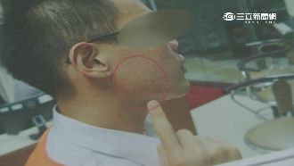 路倒醉男襲擊救護員　遭警壓制上銬