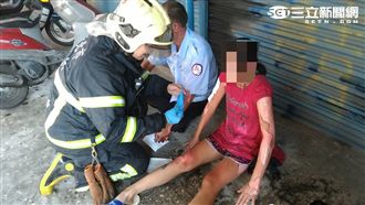 新北市民宅疑氣爆　父女同遭火吻送醫