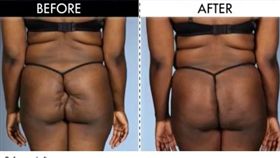 她35歲沒交過男友　原因都在沒股溝（圖／翻攝自鏡報）
