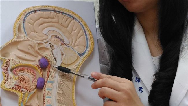 鼻塞+嚴重打鼾聲　5歲童小臉險變形