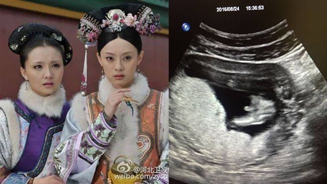 3顆心！《甄嬛傳》槿汐姑姑懷孕了
