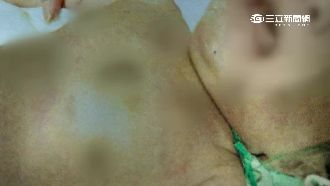 害2歲子成植物人　狠父又斷女嬰肋骨