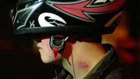 墨西哥少年被女友種草莓導致大腦而中風死亡。（圖／翻攝自鏡報）