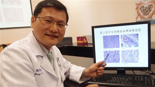 子宮內膜癌率攀升　躍女性癌症前十大