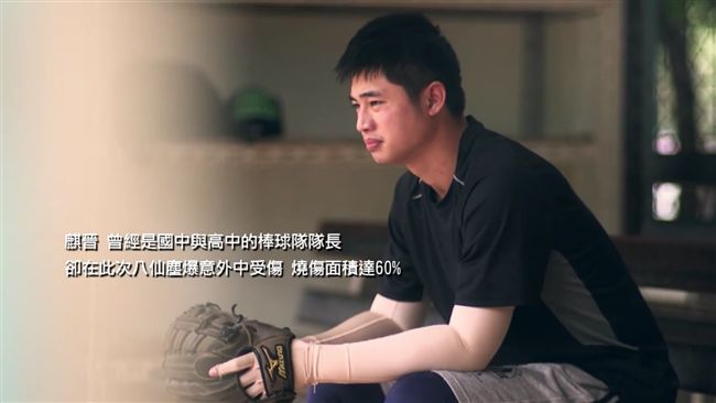義大推廣臉部平權　招待陽光傷友看球