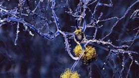 阿茲海默症,http://www.dailymail.co.uk/health/article-3767488/Is-cure-Alzheimer-s-sight-Unprecedented-trial-sees-drug-clear-toxic-proteins-brain.html