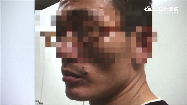 嘴角「痣」藏不住　通緝犯栽在他手上