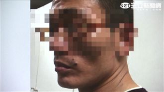 嘴角「痣」藏不住　通緝犯栽在他手上