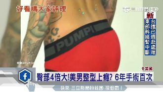 美男整型上癮　屁屁塞矽膠變成4倍大