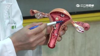 四物豆漿催生子宮肌瘤　中西醫破迷思