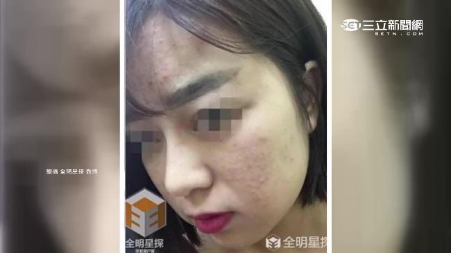 張庭創保養品牌　消費者控：用後臉爛