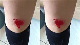 網友自摔閃貓／翻攝自爆廢公社