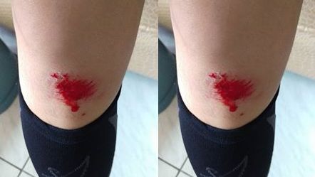 貓咪從車子底盤爆衝　騎士自摔保護牠