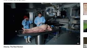 英國《BBC》紀錄片《Obesity：the post mortem》,肥胖,女屍體,解剖,內臟／翻攝自鏡報