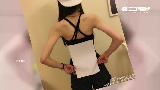 A4腰不健康？恐脊椎變形、月經不順