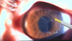 W烤肉險瞎眼1200