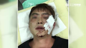 打女生不好？男KTV莫名遭圍毆